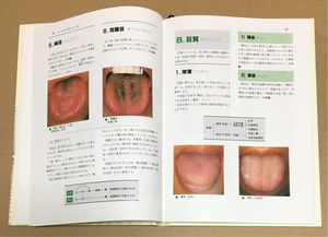 舌診と脈診 中醫臨床における実踐的アプローチの再検討